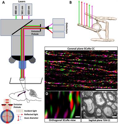 Imaging and Quantification of Myelin Integrity After Injury With Spectral Confocal Reflectance Microscopy